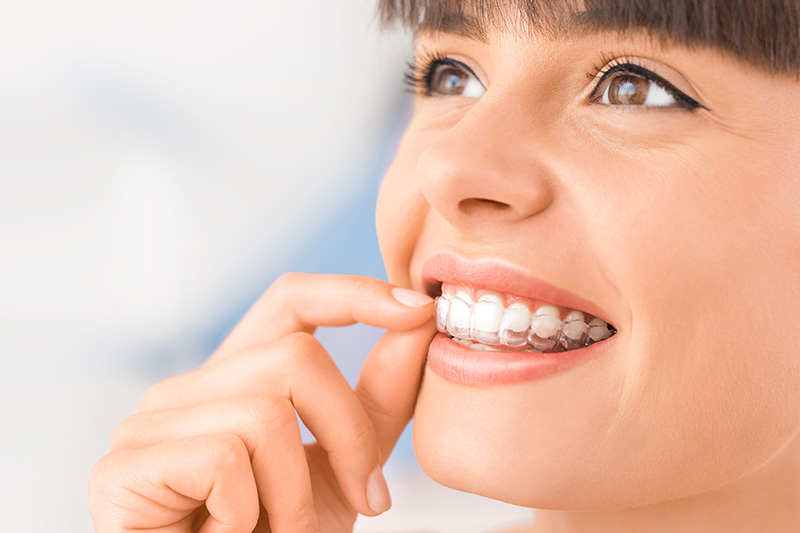 Invisalign Clear Aligners in Garden Grove